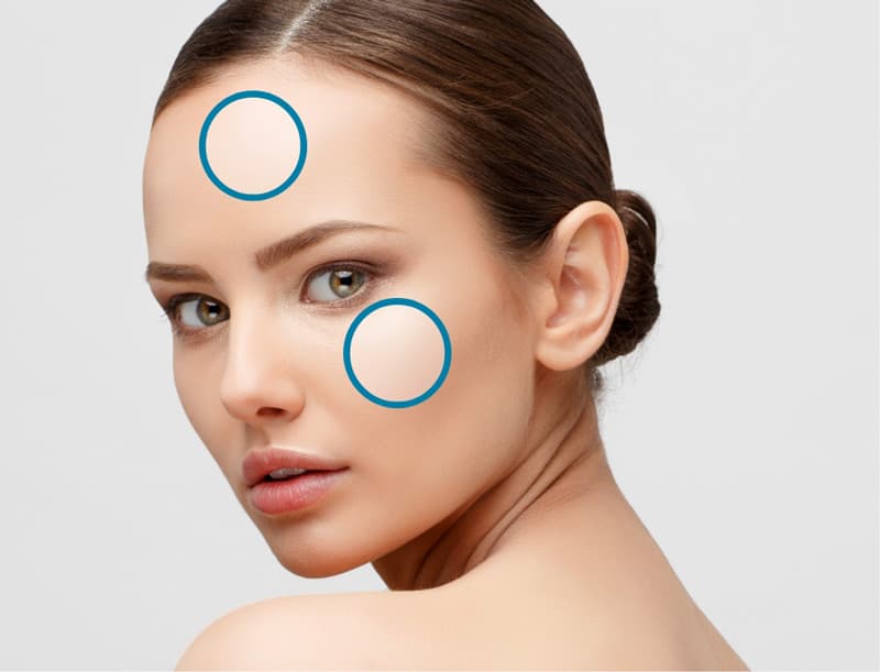 Treatment planner model showing brown spots / discoloration area