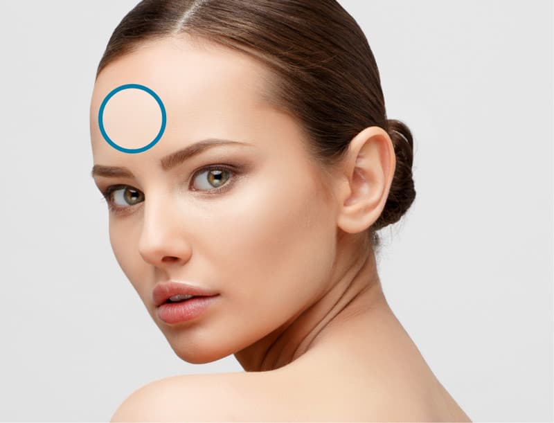 Treatment planner model showing fine lines & wrinkles area