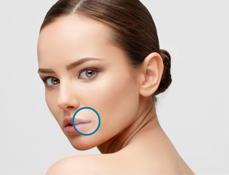 Treatment planner model showing lip lines area