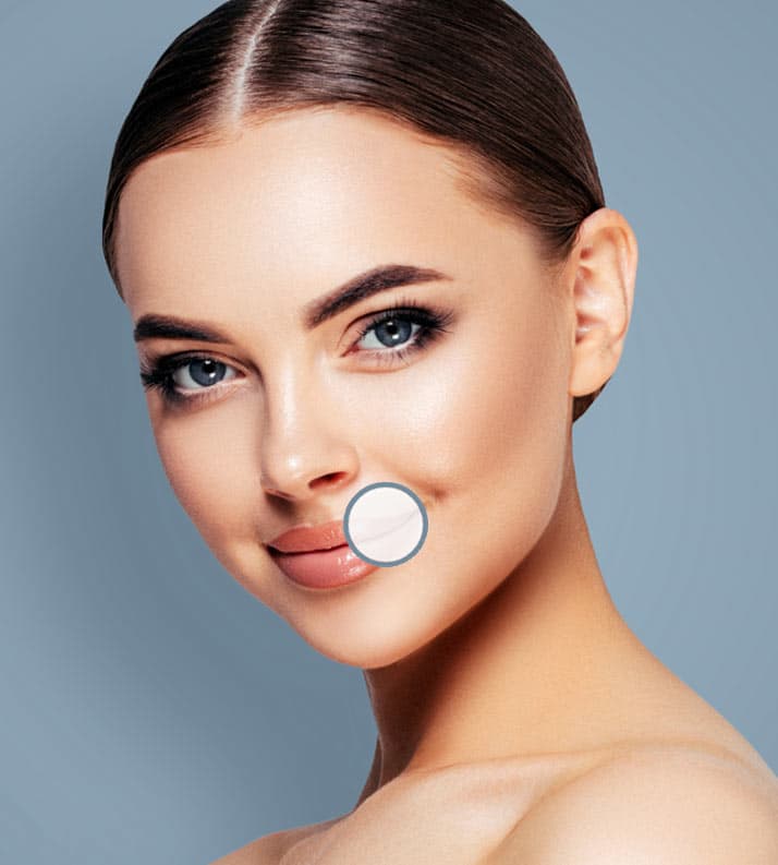 Treatment planner model showing thin lips areas