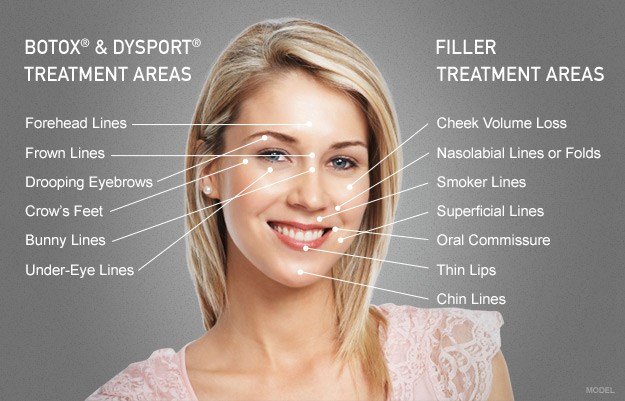 BOTOX® & Dysport® Treatment Areas