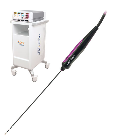 Renuvion system and handpiece