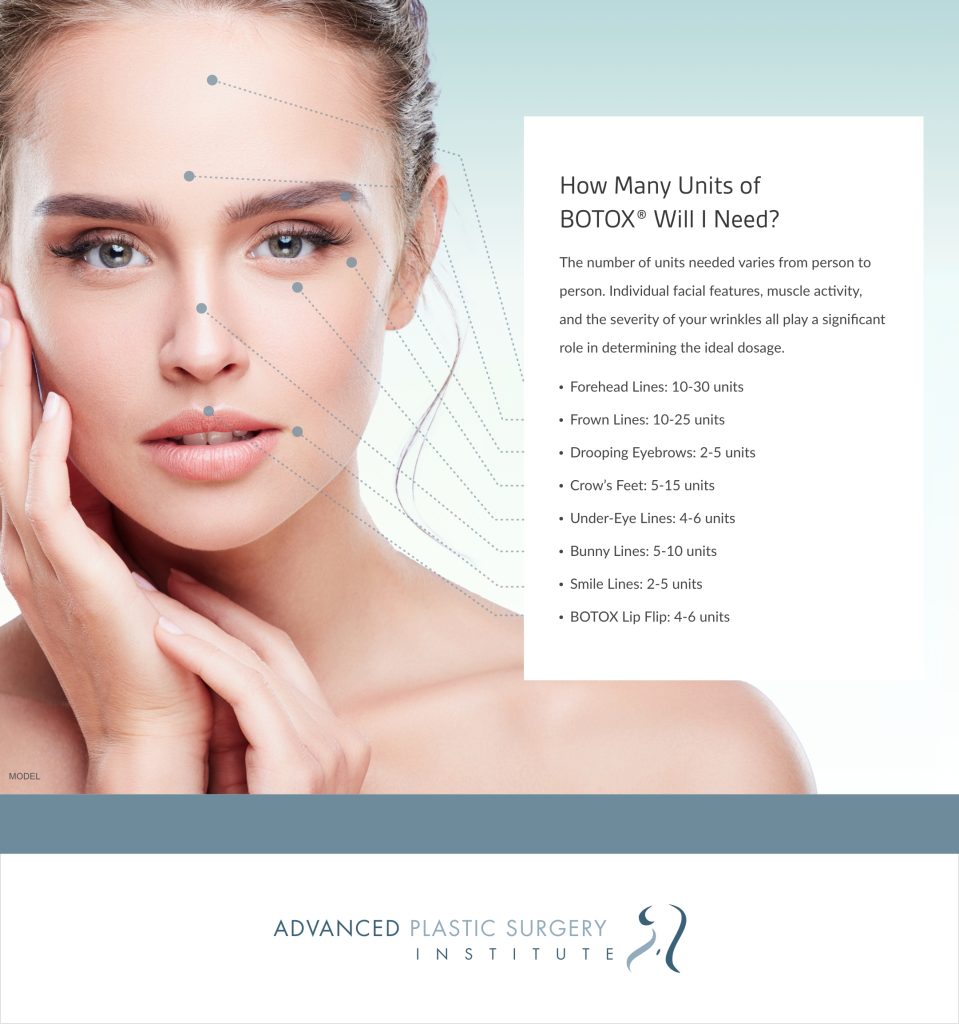 Inforgraphic: How many units of Botox will I need?