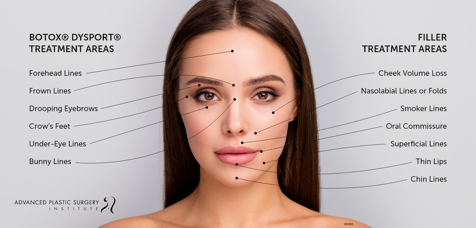 Infographic illustrating botox and filler treatment areas.