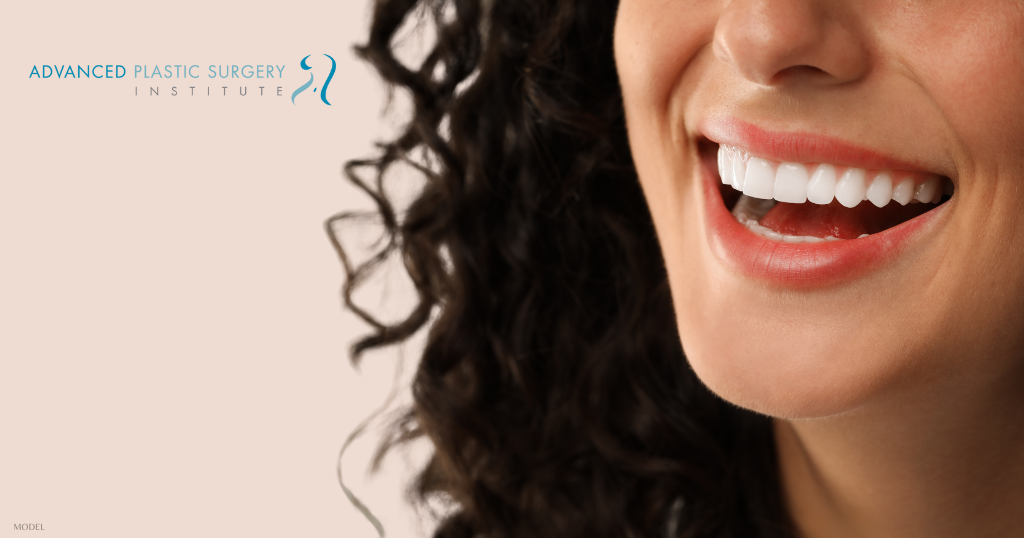 Close up of a woman's smile. (Model)