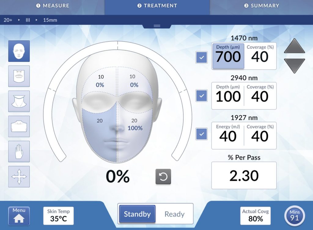 HALO TRIBRID laser treatment interface showing facial mapping and customizable wavelength settings.