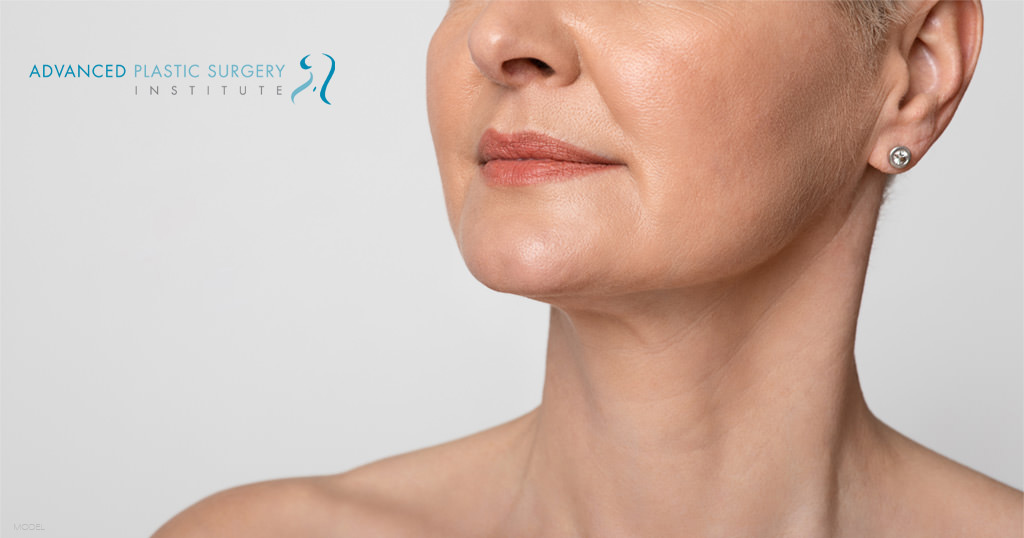 Lower half of woman's face (model) with a full and smooth complexion.